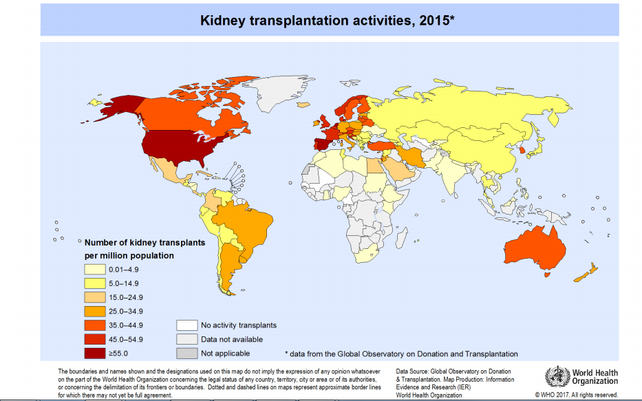 Kidney Transplant Regions Map